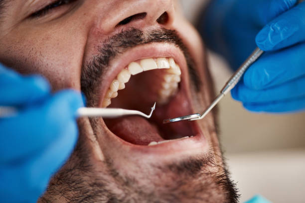Best Dental Bonding  in Mulgee, OK